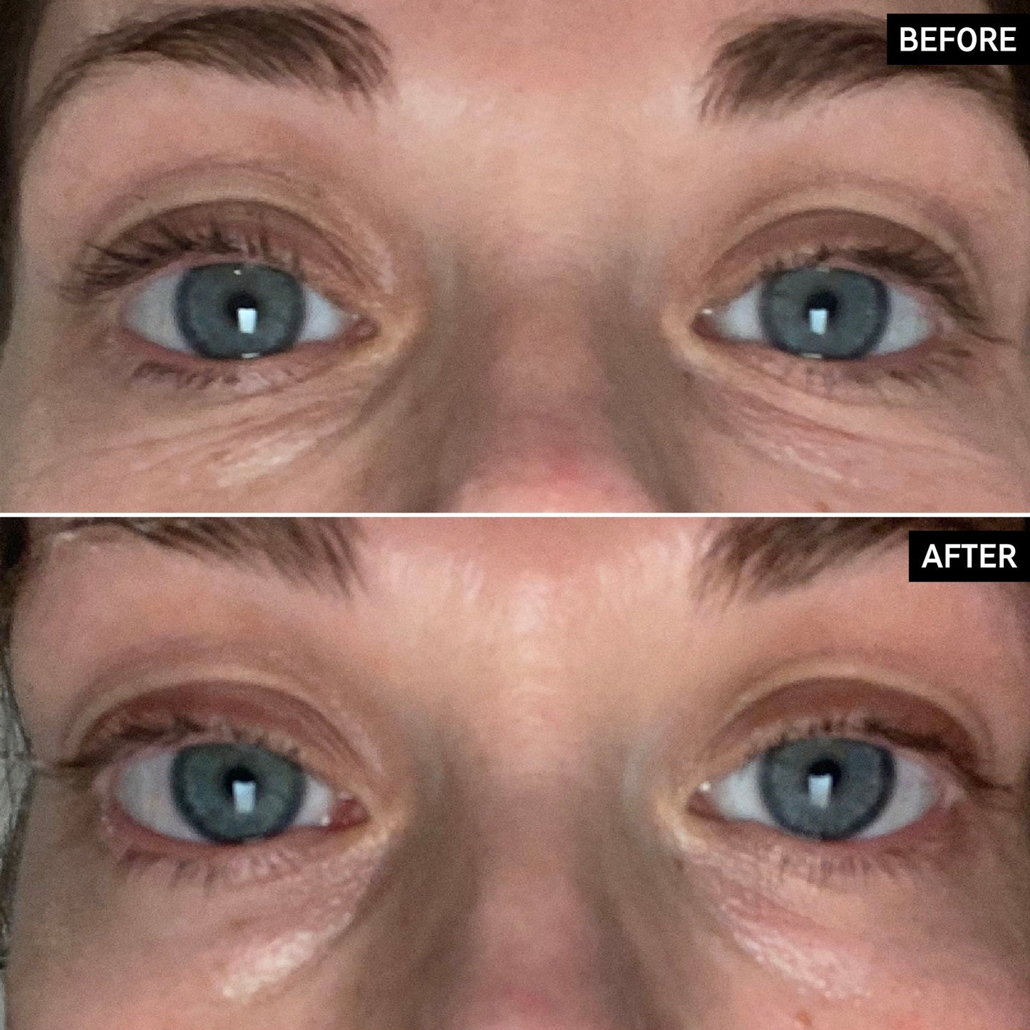 retinol-eye-cream-q7 SITE-UGCBAsApril_Nicole_B_A_PPage_2000x2000_1.jpg