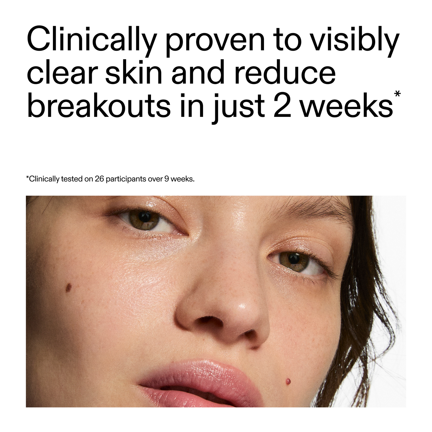 360-acne-clearing-duo-k7 360_Serum_Key_Claim.png