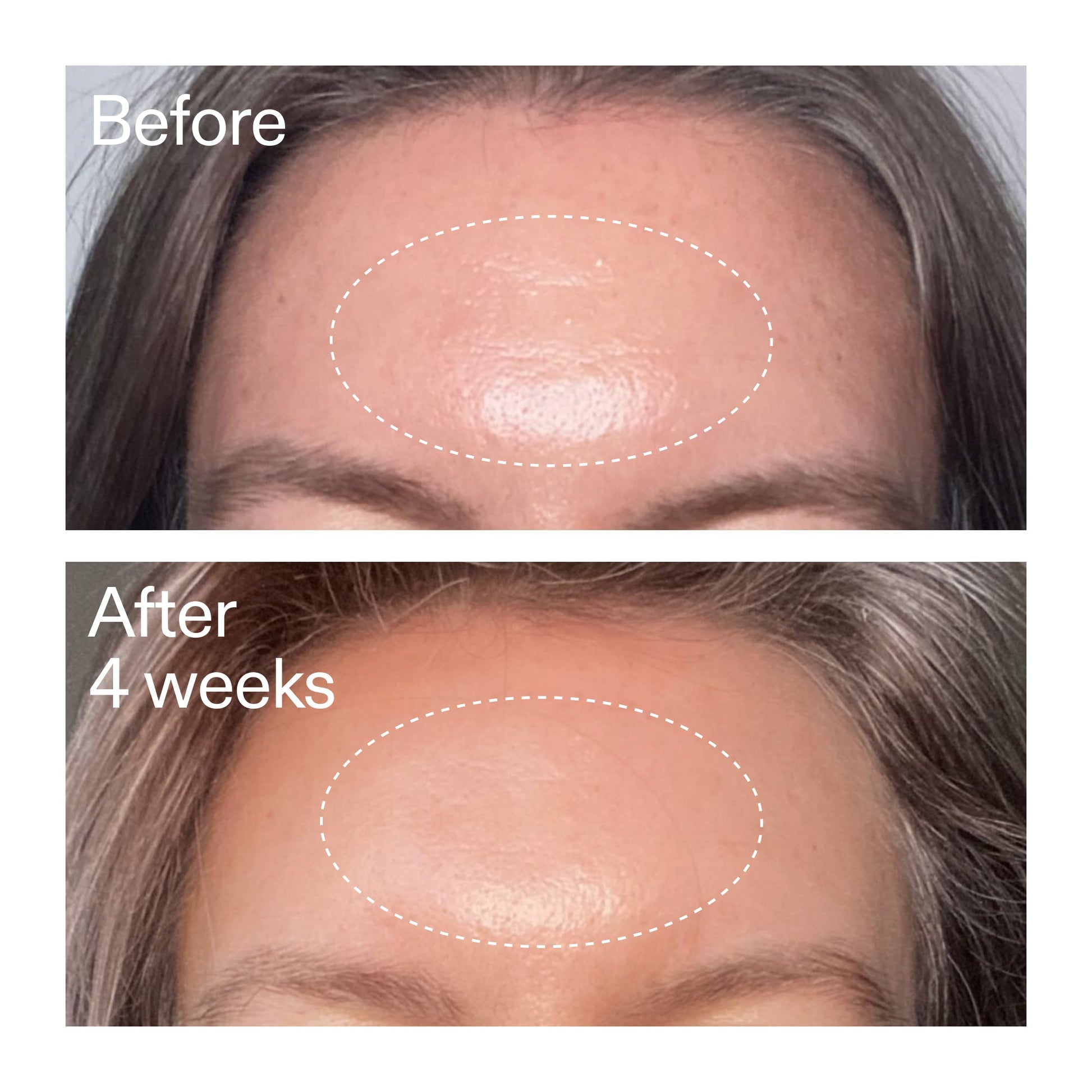 advanced-0-2-retinal-serum-n5 AdvancedRetinal_BeforeAfter1_2000x2000_1da6bb0a-29dd-41d1-95b7-8679696bbf0f.jpg
