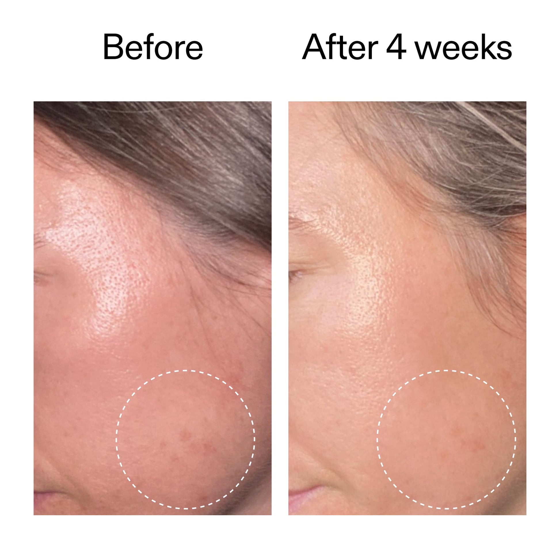 advanced-0-2-retinal-serum-n5 AdvancedRetinal_BeforeAfter2__2000x2000_62fb16bb-77ae-4d63-8500-88dbf847f4b9.jpg