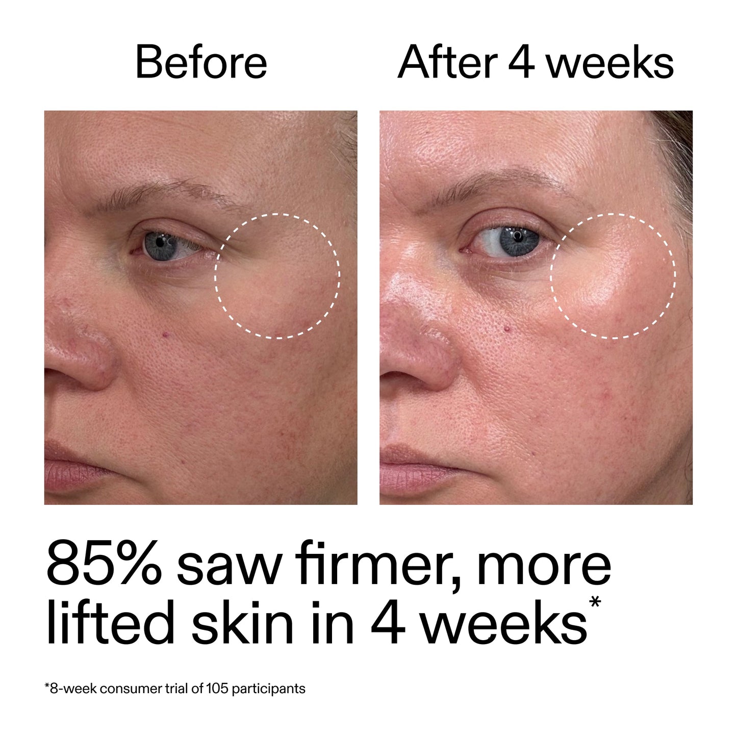 advanced-0-2-retinal-serum-n5 AdvancedRetinal_BeforeAfter_Claim1_2000x2000_bcc385c4-5e73-4f1e-aba8-64267937d0d3.jpg