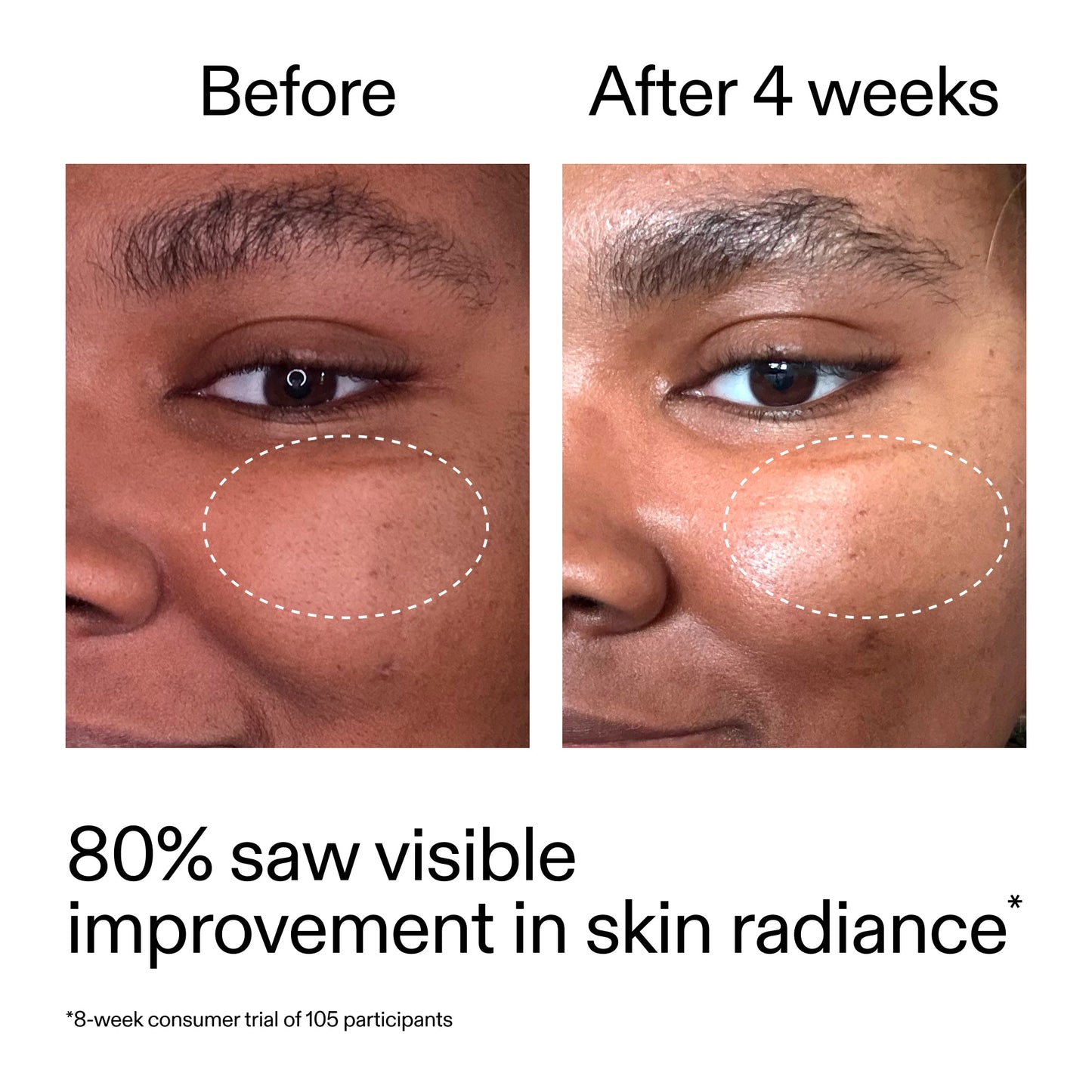 advanced-0-2-retinal-serum-n5 AdvancedRetinal_BeforeAfter_Claim2_2000x2000_39d11e3d-eda9-44ec-ab32-2903b1a368bd.jpg