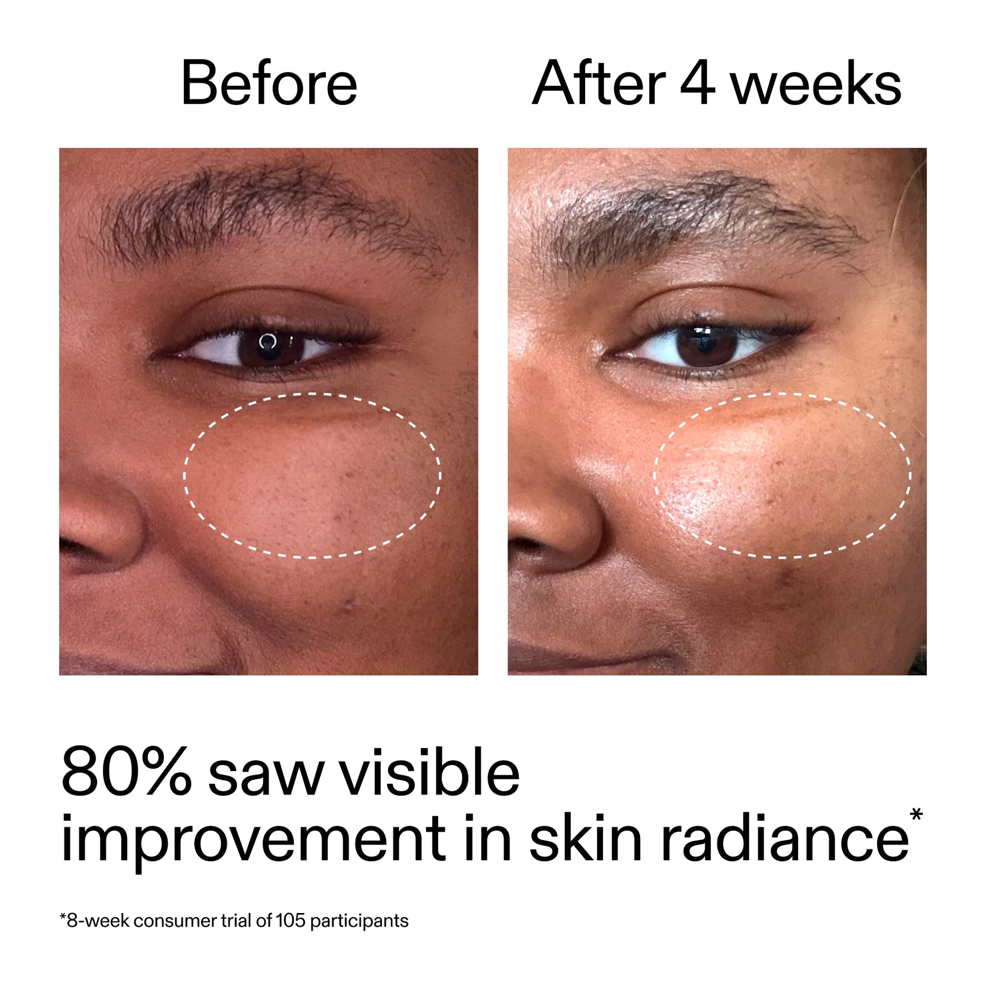 advanced-0-2-retinal-serum-n5 AdvancedRetinal_BeforeAfter_Claim2_2000x2000_39d11e3d-eda9-44ec-ab32-2903b1a368bd.jpg