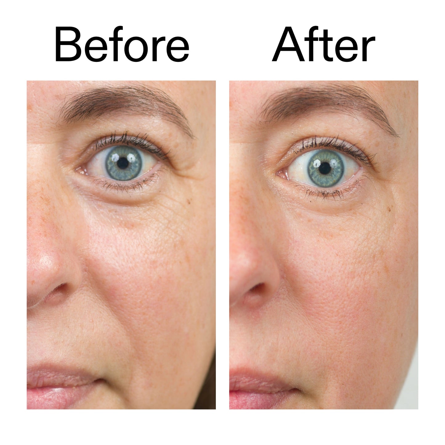 bio-active-ceramide-moisturizer-duo-z9 Bio-Active_Before_After_2000x2000_566e5a9e-135e-417a-8242-b44e5fa35463.jpg