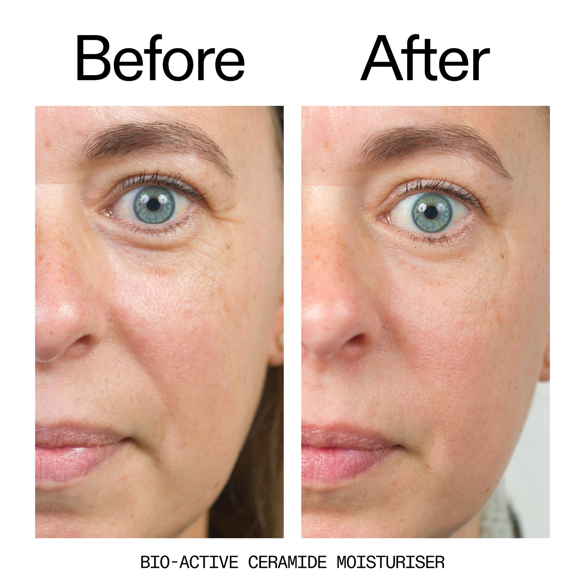 barrier-boosting-trio-p5 Bio-Active_Before_After_2000x2000_600947b4-e8c5-425a-9155-fc15bc83aa12.jpg