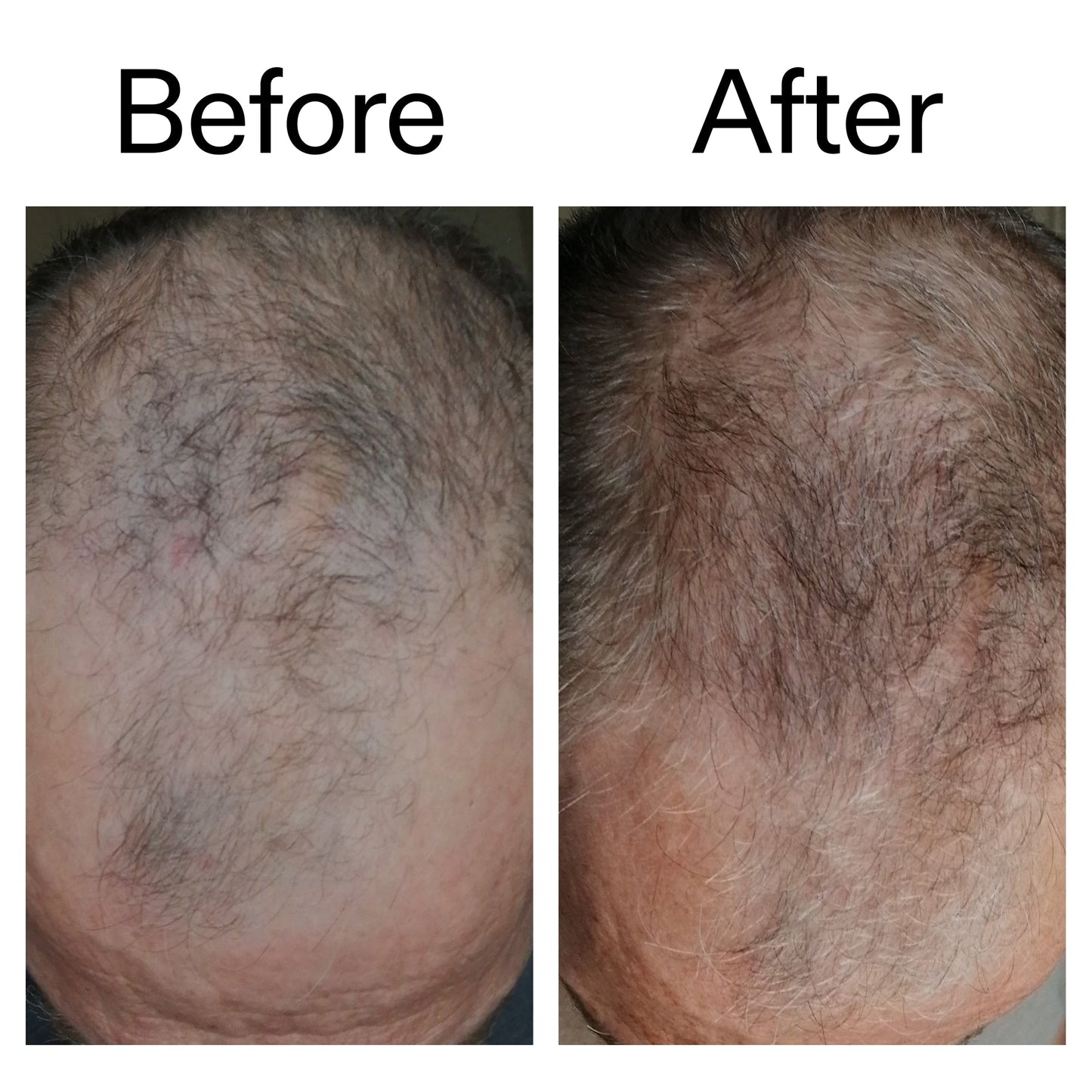 caffeine-stimulating-scalp-treatment-f4 Caffeine_Scalp_Treatment_B_A_Ppage_2000_x_2000.jpg