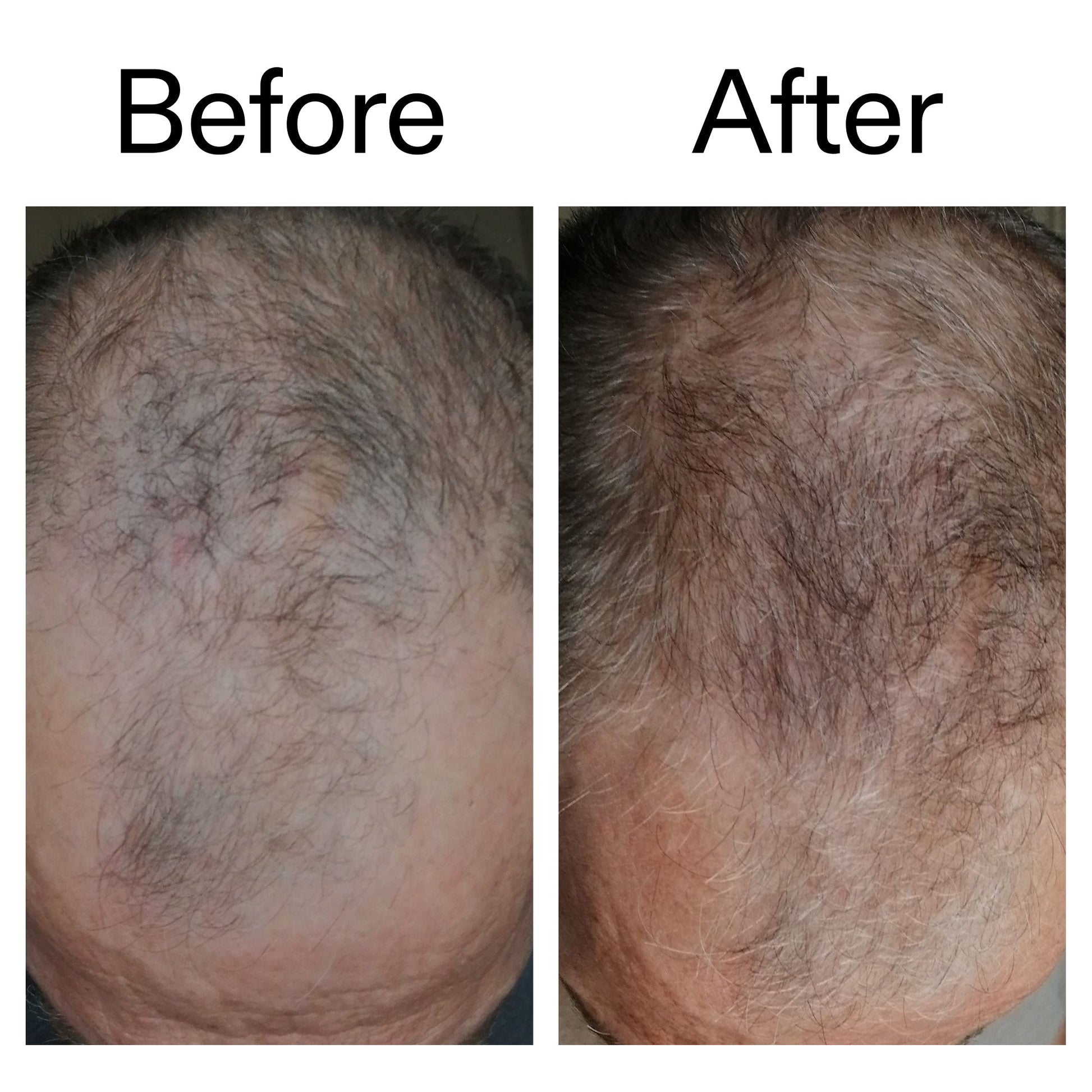 caffeine-stimulating-scalp-treatment-f4 Caffeine_Scalp_Treatment_B_A_Ppage_2000_x_2000.jpg
