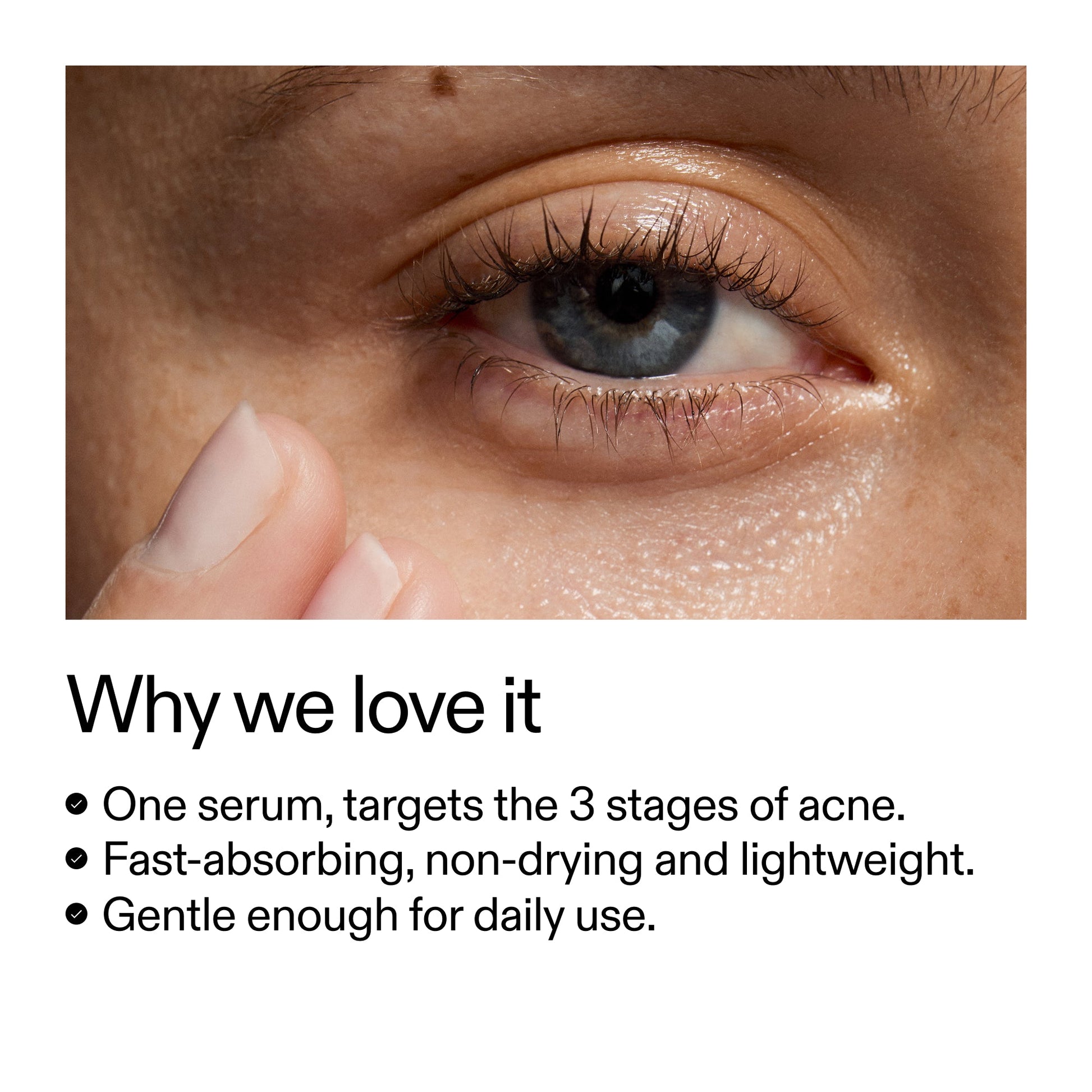 360-acne-clearing-duo-k7 Dioic_Whyweloveit_2000x2000_175aafd3-0cbe-403a-b317-a8362881bfe2.jpg