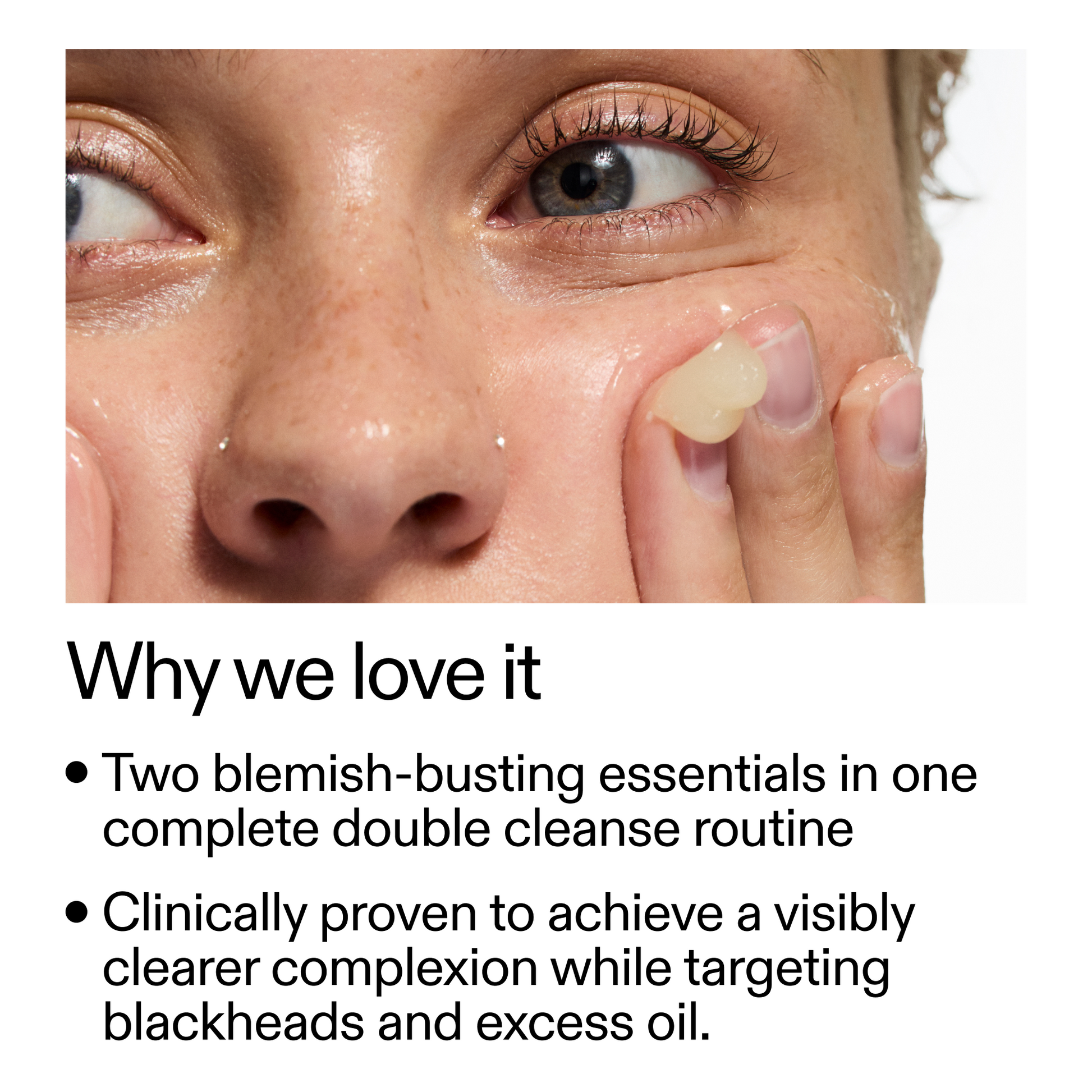 acne-double-cleanse-duo-q4 Double_Cleanse_Duo_for_Breakouts_Why_We_2000x2000_f242cb12-bb5c-487c-b203-071ccb406ec5.png
