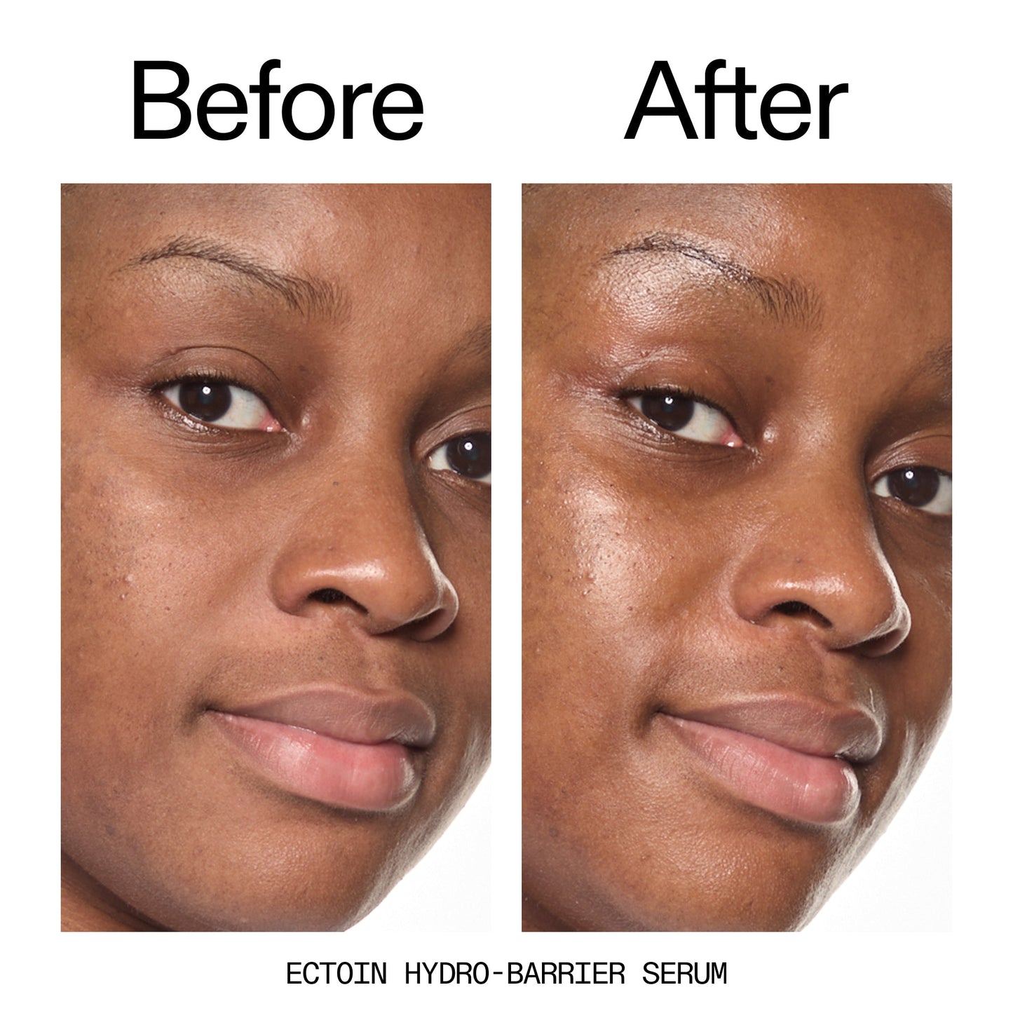 barrier-boosting-trio-p5 Ectoin_Before_After_2000x2000_ce35bc41-4da0-4b6f-adc7-29f8641f6c6c.jpg