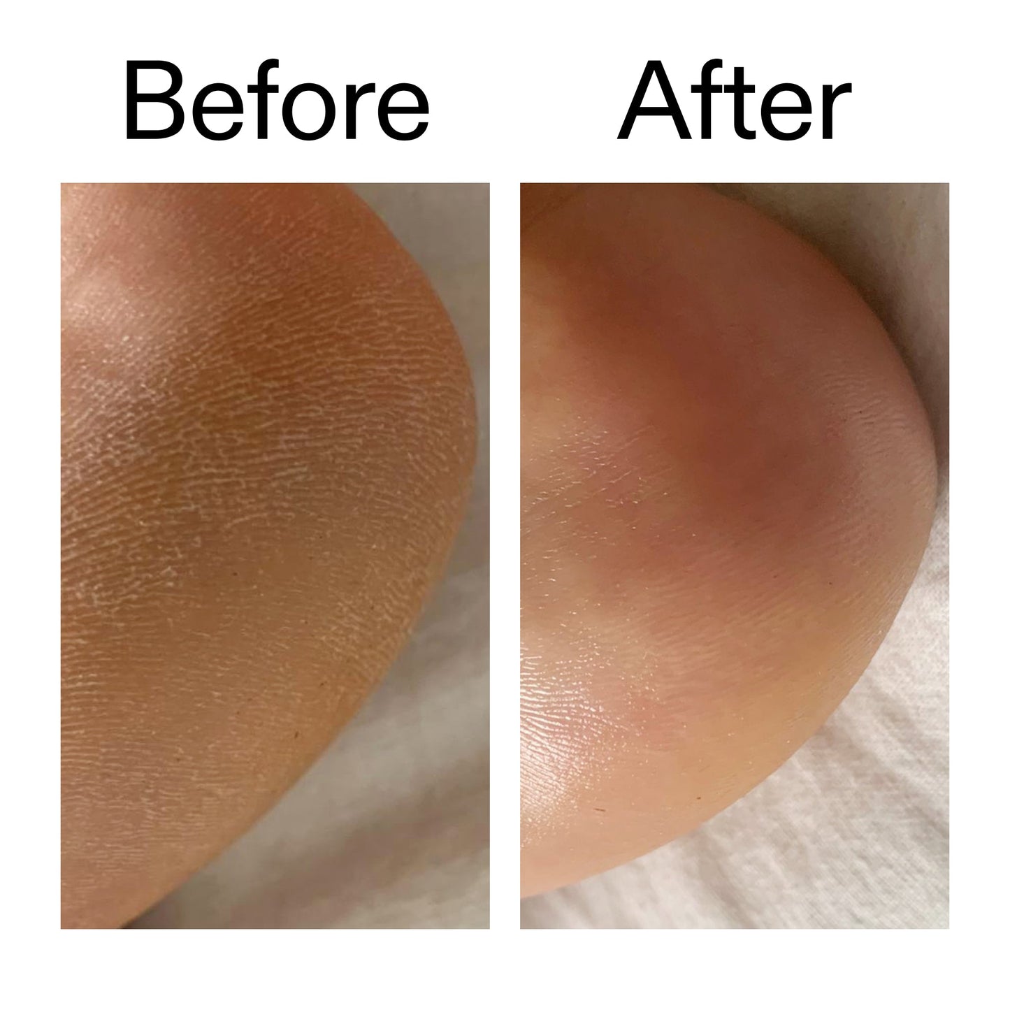 glycolic-acid-exfoliating-body-stick-duo-y7 Glycolic_Acid_Exfoliating_Body_Stick_Before_After_V1_2000x2000_a3043625-9400-429a-a7fb-d6dbd220f722.jpg