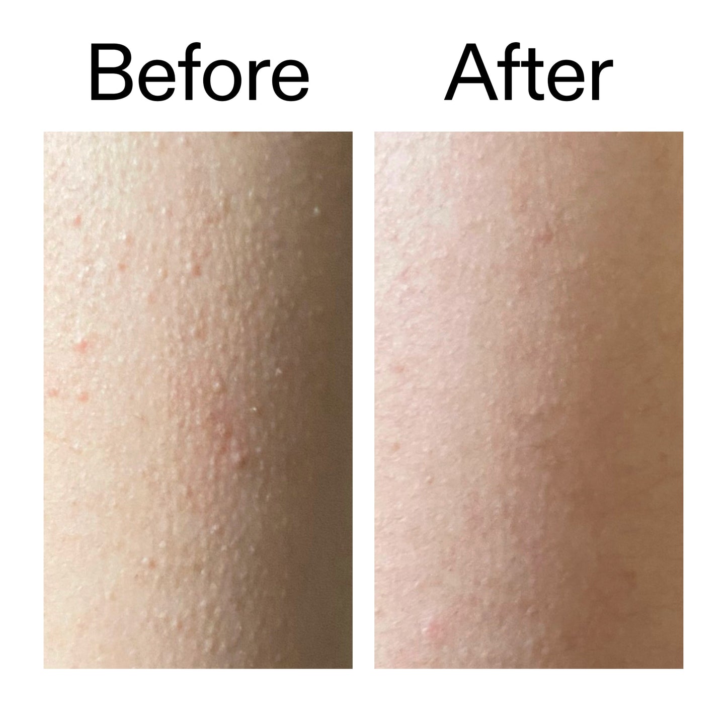 glycolic-acid-exfoliating-body-stick-duo-y7 Glycolic_Acid_Exfoliating_Body_Stick_Before_After_V2_2000x2000_2e4ba052-94f6-4d56-82df-7bdb5b2df7ae.jpg