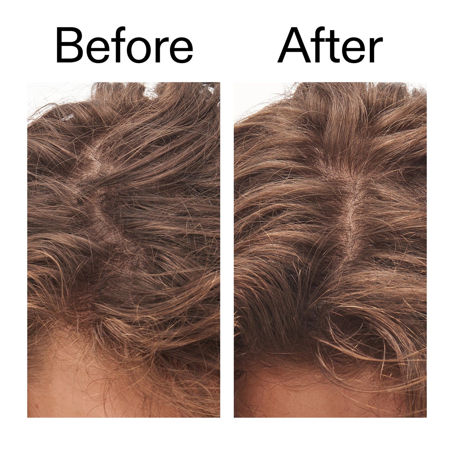 glycolic-acid-exfoliating-scalp-scrub-w7 Glycolic_Acid_Exfoliating_Scalp_Scrub_Before_After_2000x2000_b8561c87-05a1-4caa-80f7-1b6b33d750f7.jpg