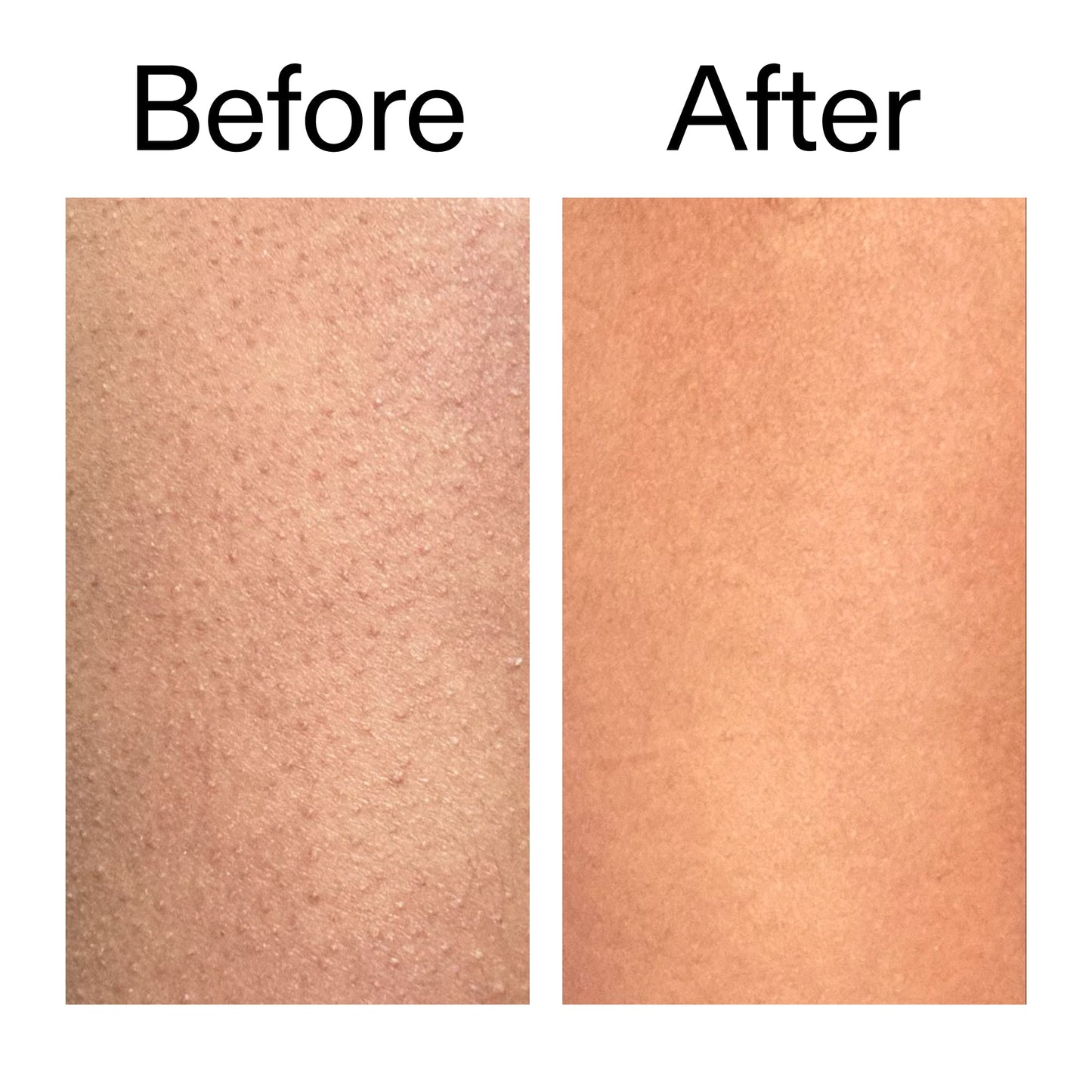 glycolic-acid-exfoliating-body-stick-duo-y7 Glycolic_Body_Stick_B_A_2000x2000_6e6e6b4d-5bd7-43c0-aeed-4d66788e8995.jpg