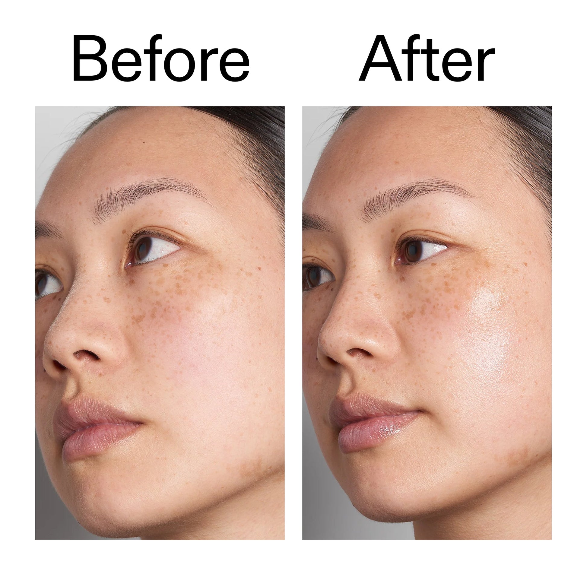 supersize-hyaluronic-acid-serum-100ml-z1 Hyaluronic_Acid_Before_After_2000x2000_d7983956-8aa2-4ea3-8255-c63e8d4f892e.jpg