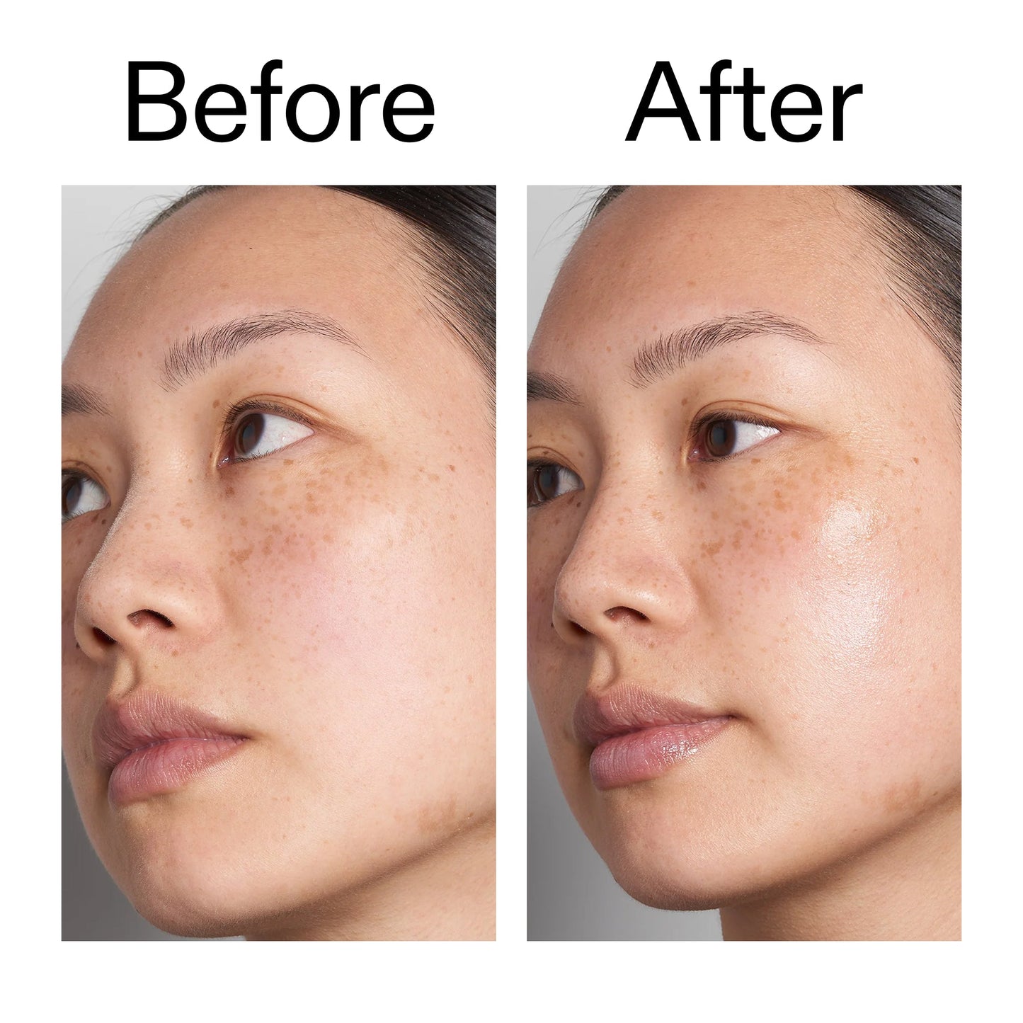 hyaluronic-acid-serum-60ml-n1 Hyaluronic_Acid_Before_After_2000x2000_d7983956-8aa2-4ea3-8255-c63e8d4f892e.jpg
