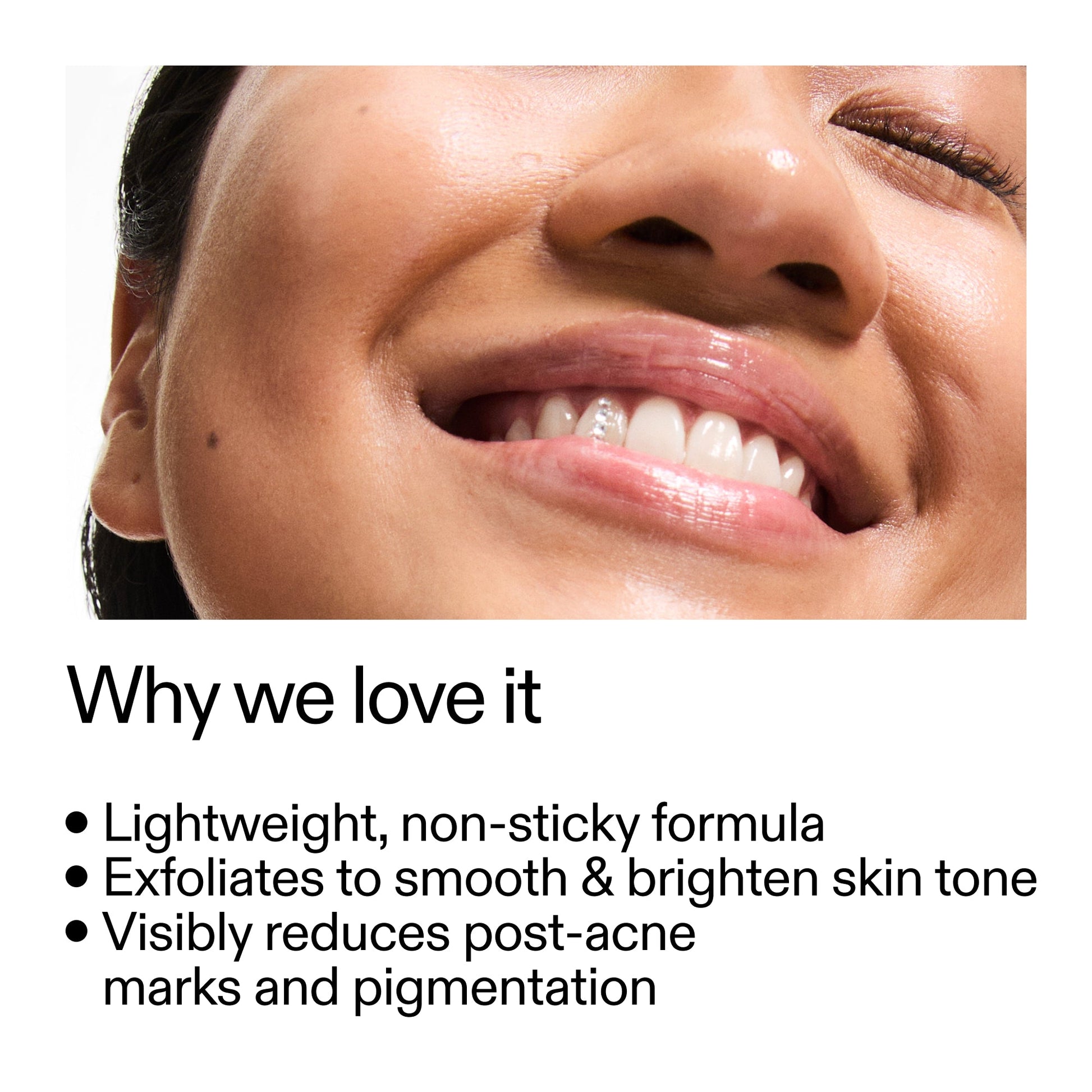 mandelic-acid-treatment-n4 Mandelic_Acid_Treatment_Why_we_love_it_2000x2000_6dfe29a9-2a79-464f-a5e8-e5ac37d93388.jpg