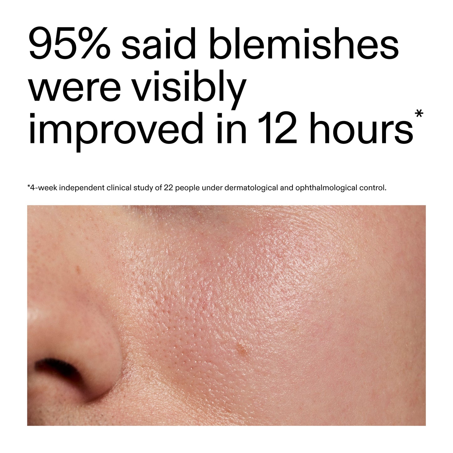 succinic-acid-acne-treatment-j8 Oat_Cleansing_Balm_Claim_2000x2000_ac6ce553-25db-41b2-a981-faae1ac4b8c0.jpg