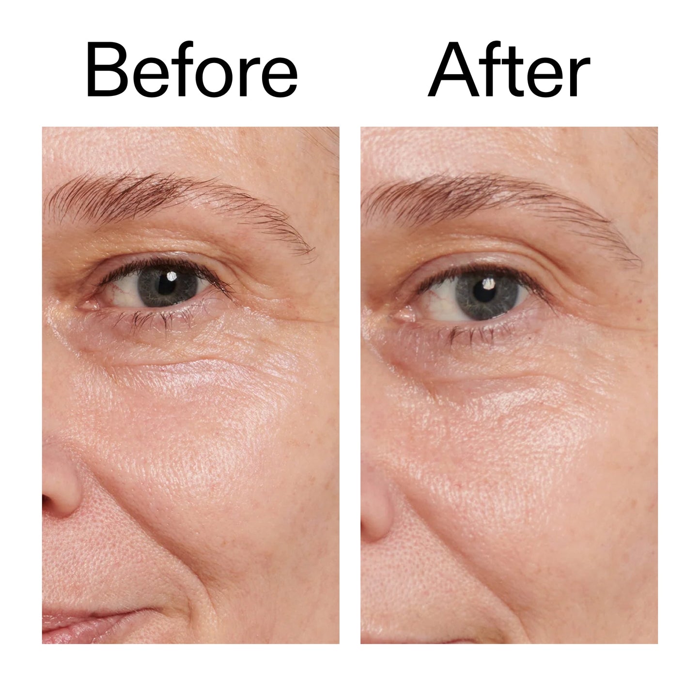 retinol-eye-cream-q7 Retinol_Eye_Cream_Before_After_2000x2000_ac03a80c-109e-4572-a95a-91dc109b4d27.jpg