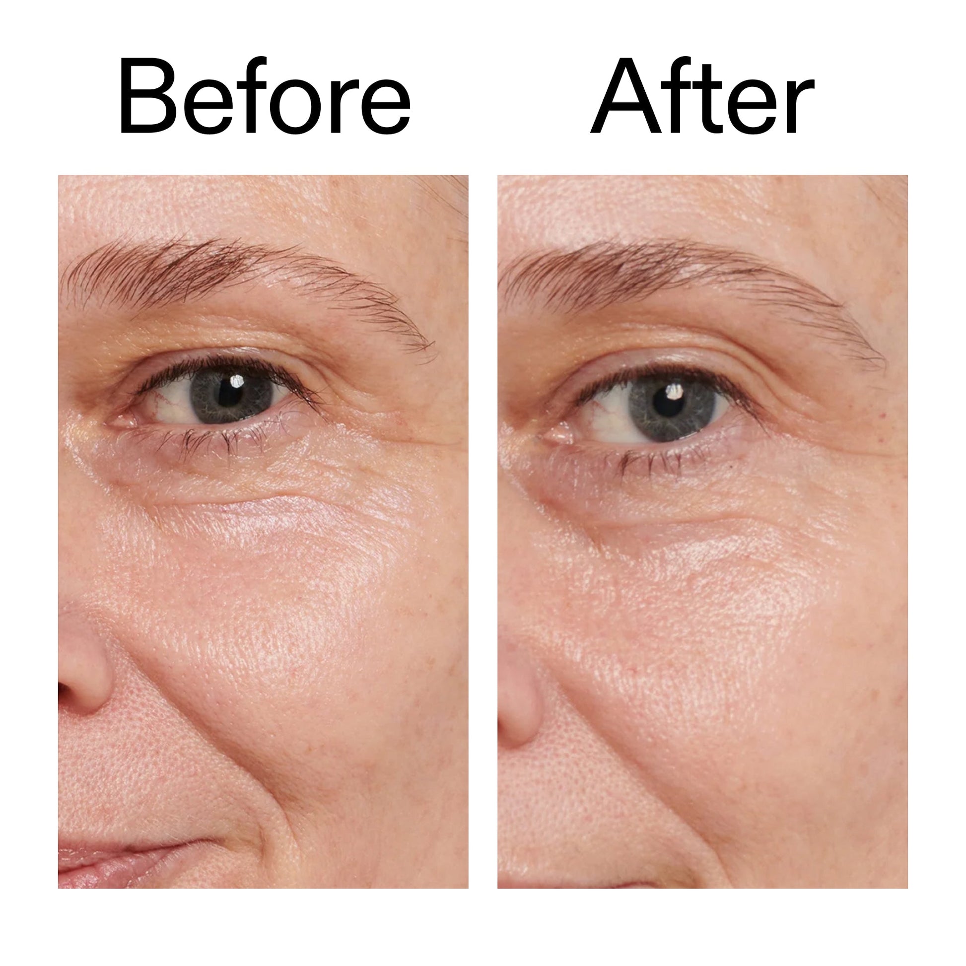 retinol-eye-cream-q7 Retinol_Eye_Cream_Before_After_2000x2000_ac03a80c-109e-4572-a95a-91dc109b4d27.jpg