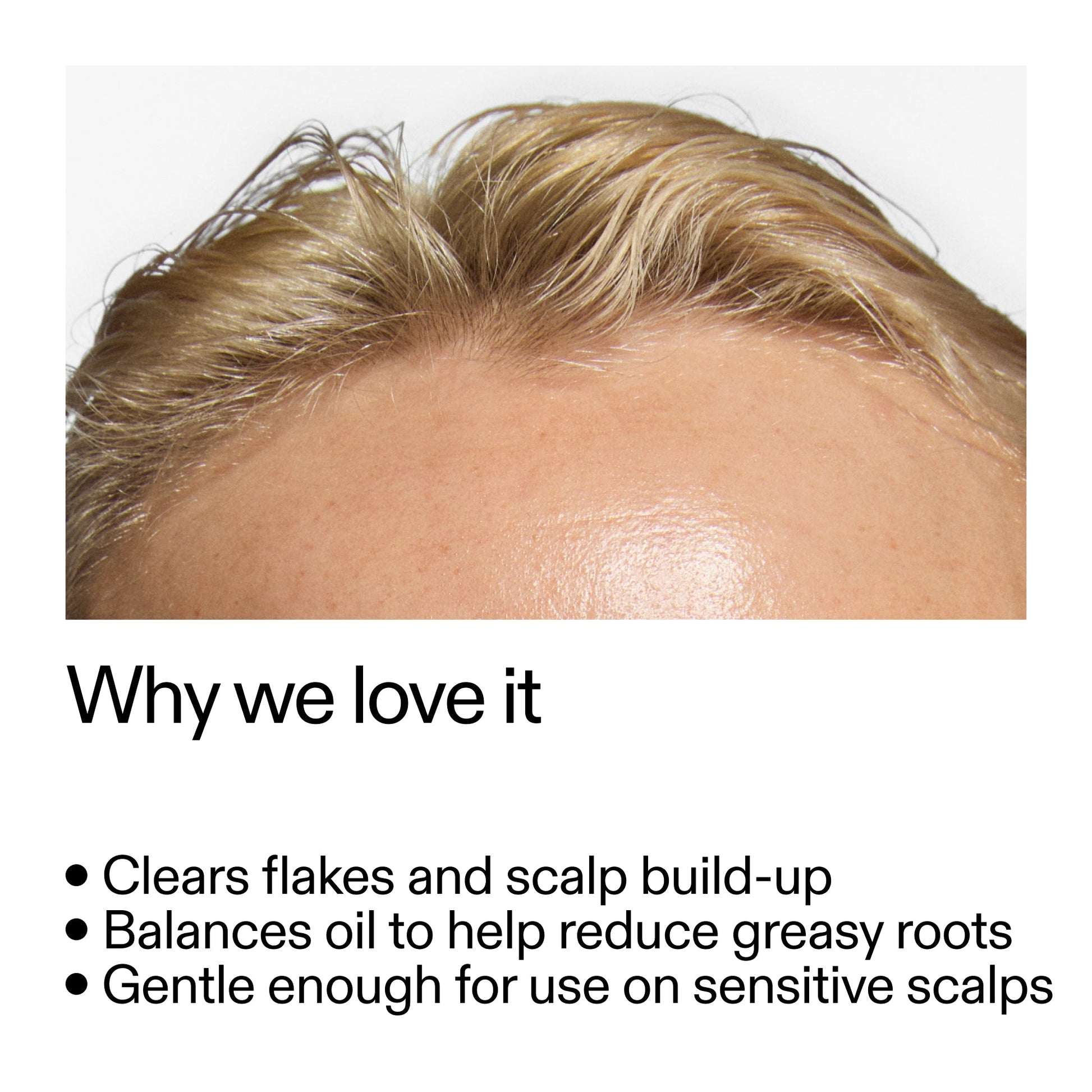 salicylic-acid-exfoliating-scalp-treatment-f9 Salicylic_Acid_Exfoliating_Scalp_Treatment_Why_we_love_it_2000x2000_44b6bd6d-9ec4-4b23-9dc4-bc3fd6f28e14.jpg