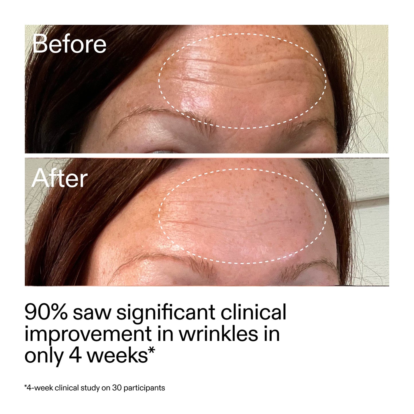 starter-retinol-serum-x0 StarterRetinol_BeforeAfter_Claim1_2000x2000_a09b50b6-4688-4527-abae-21bd142b89b7.jpg
