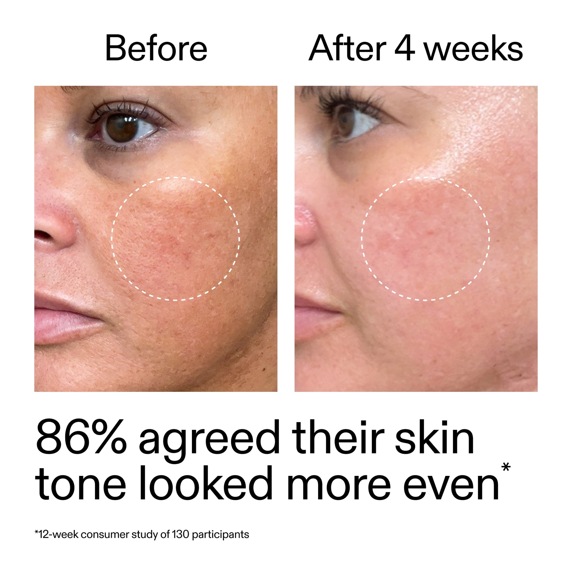 starter-retinol-serum-x0 StarterRetinol_BeforeAfter_Claim2_2000x2000_f5c9ecc0-8d76-429d-bef5-c3a61bcf5c09.jpg