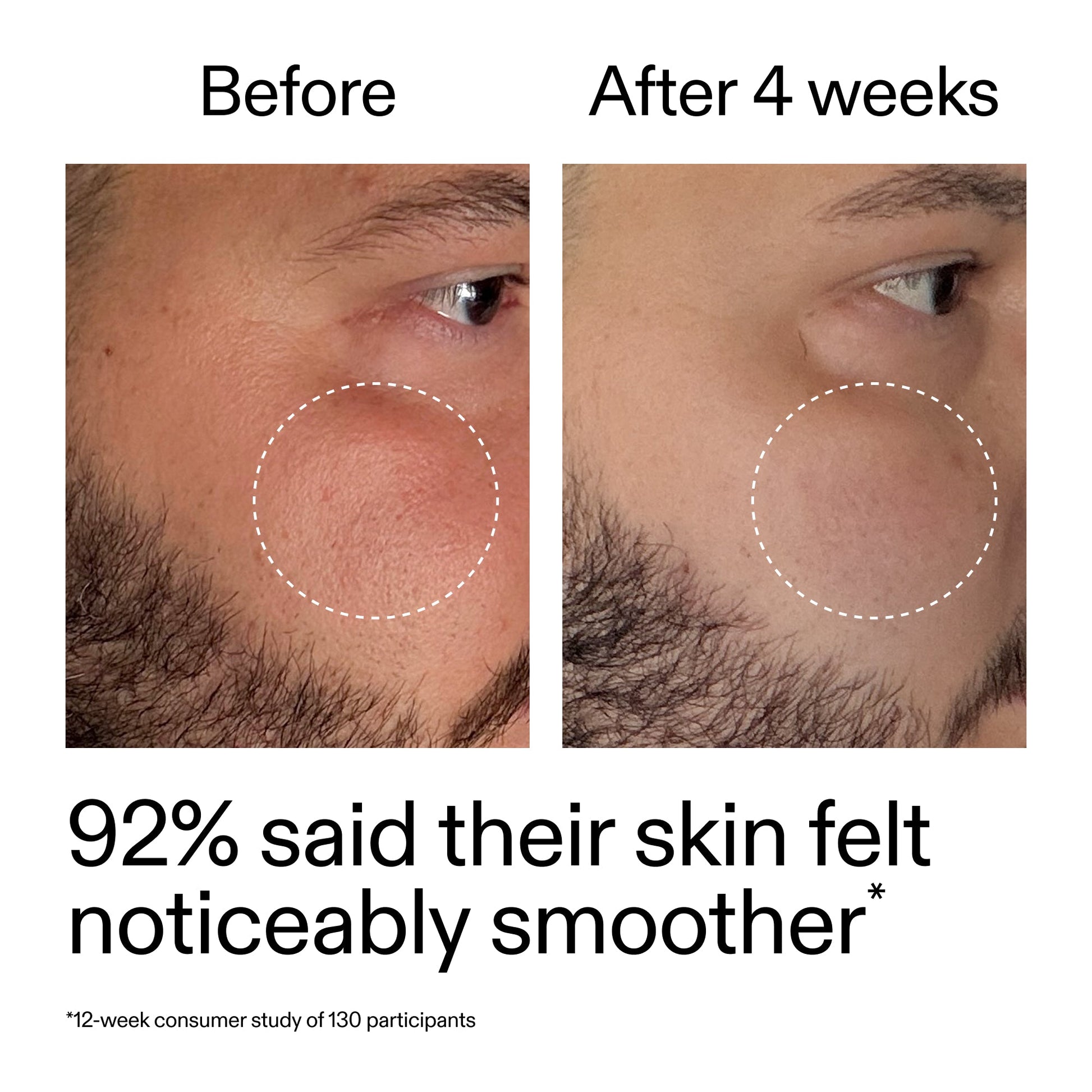 starter-retinol-serum-x0 StarterRetinol_BeforeAfter_Claim3_2000x2000_6ceab106-e0ee-4ed4-ba62-41bc39538038.jpg