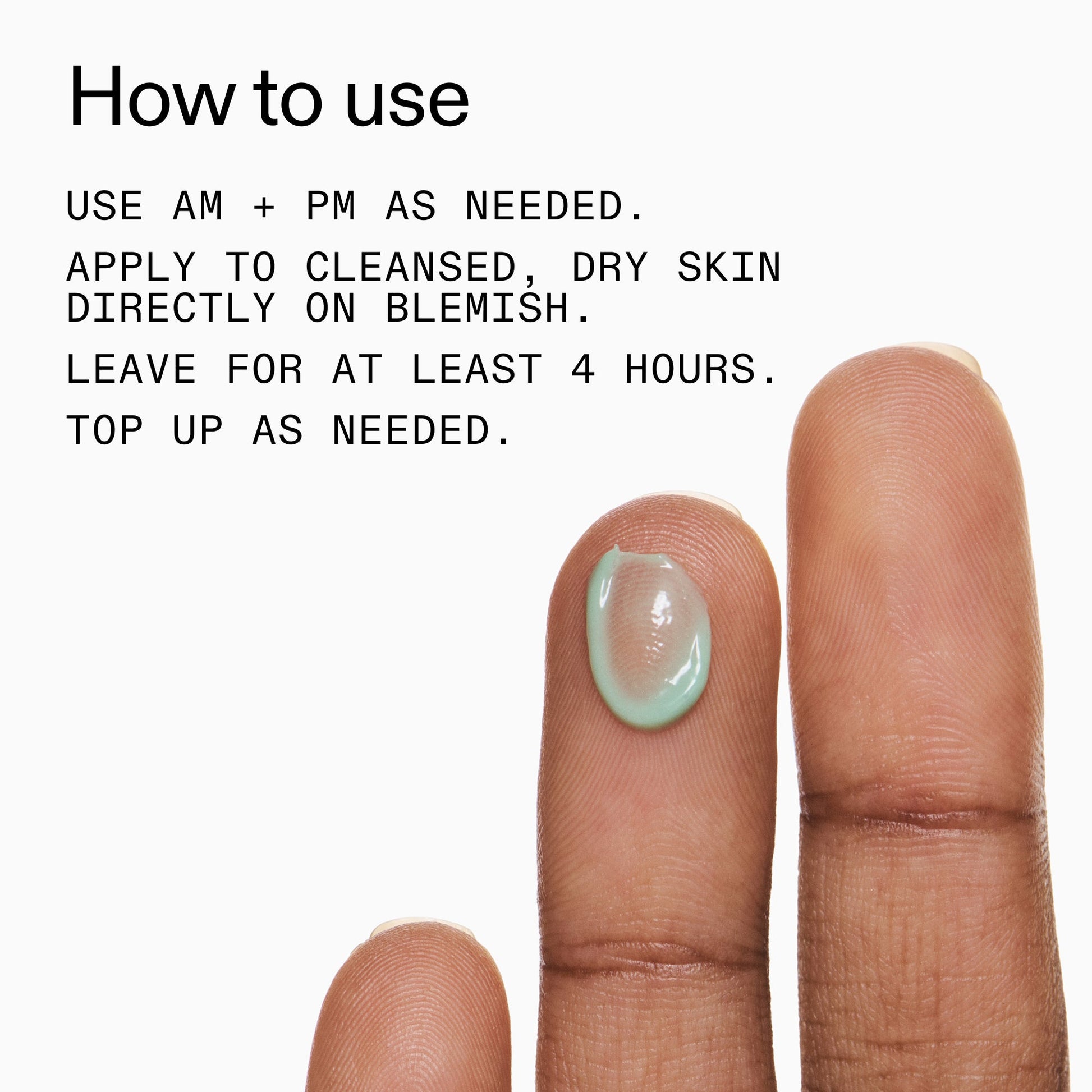 succinic-acid-acne-treatment-j8 Succinic_Acid_Treatment_How_to_Use_2000x2000_d57137d5-d7f1-427c-9a46-5fc00c19c542.jpg