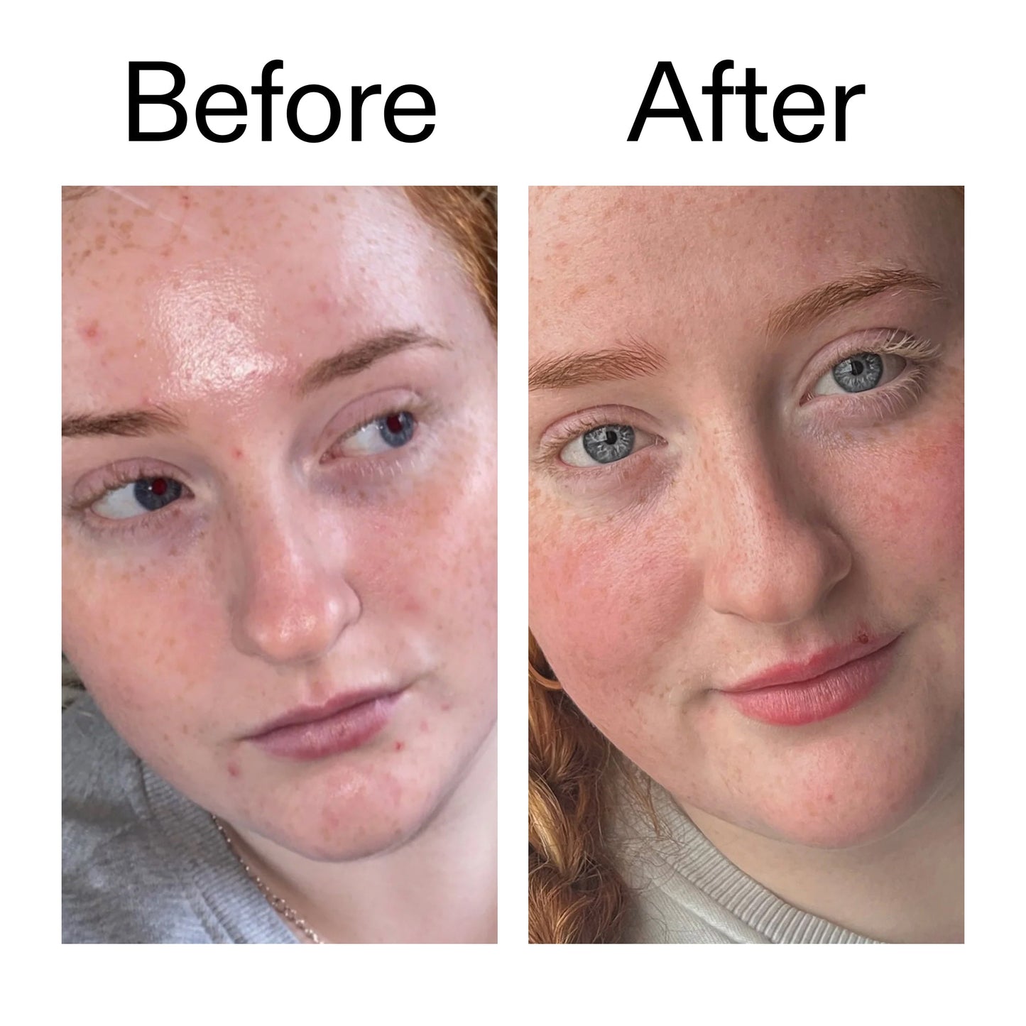 vitamin-b-c-and-e-moisturizer-i6 Vitamin_B_C_and_E_Moisturizer_Before_After_2000x2000_b0781a76-5ad2-4be9-95b8-ef92b356833c.jpg